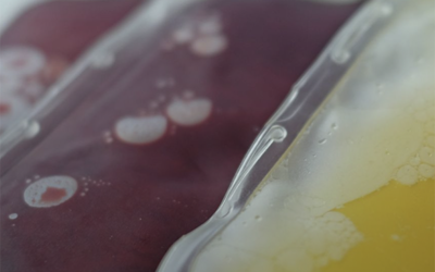 Donare il sangue riduce i livelli di PFAS in circolazione
