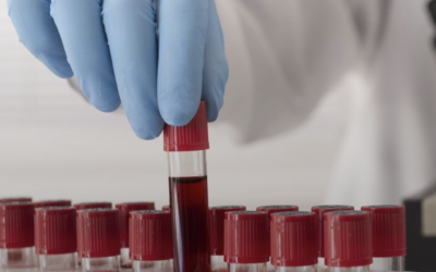 «Sangue artificiale? Una prospettiva di difficile applicazione clinica»